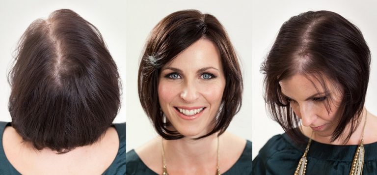 Haircuts For Balding Women Tunnel Bar La 5614